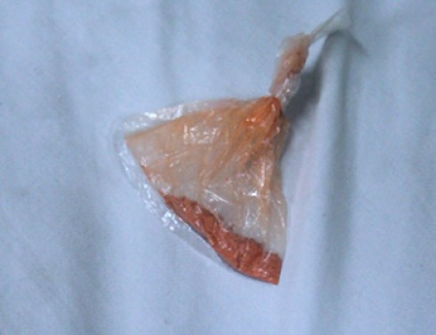 The orange coloured powdered oriental medicine that was used to treat children suffering from thrush in Hanoi (Photo: VnExpress) The orange coloured powdered oriental medicine that was used to treat children suffering from thrush in Hanoi (Photo: VnExpress)